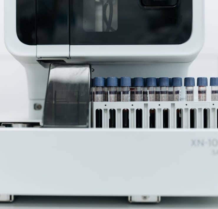 Automated laboratory equipment processing blood samples for diagnostic testing
