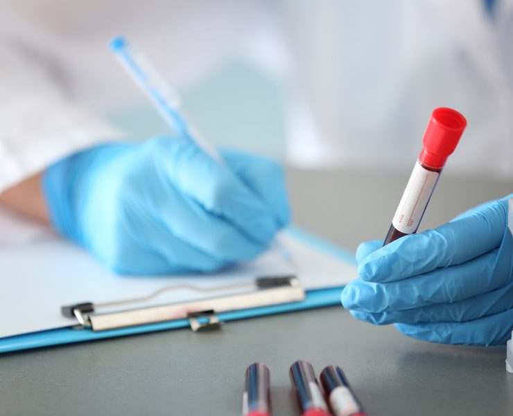 Gloved clinician holding a blood sample tube while writing notes on a clipboard