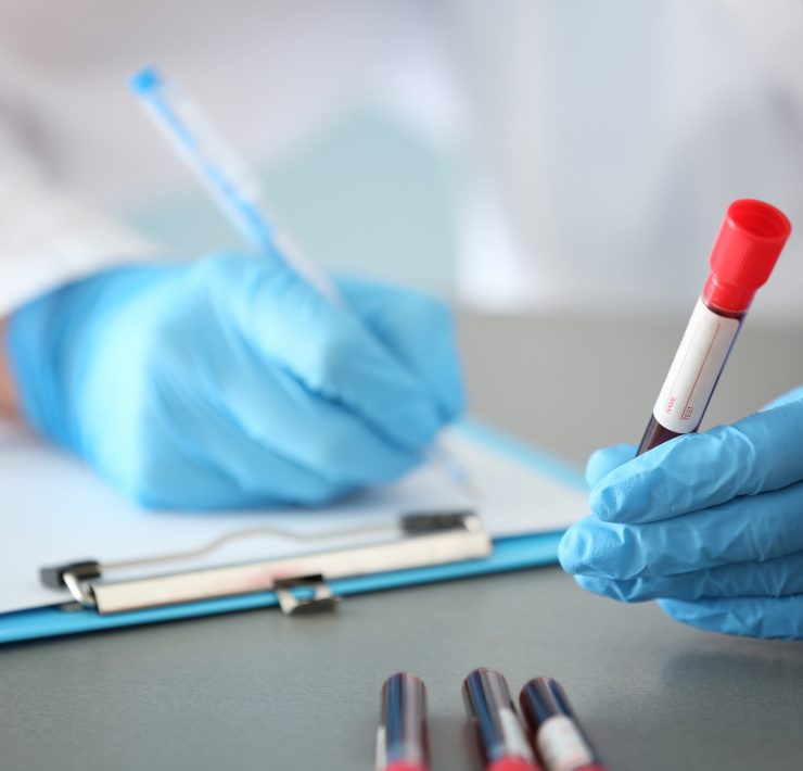 Gloved clinician holding a blood sample tube while writing notes on a clipboard
